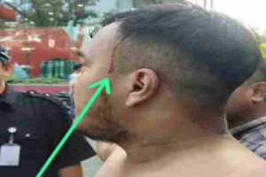 Ketua DPD MOI Medan Dianiya Oknum Security, Polrestabes Medan Didesak Segera Tangkap Pelaku