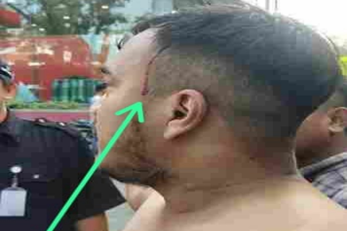 Ketua DPD MOI Medan Dianiya Oknum Security, Polrestabes Medan Didesak Segera Tangkap Pelaku