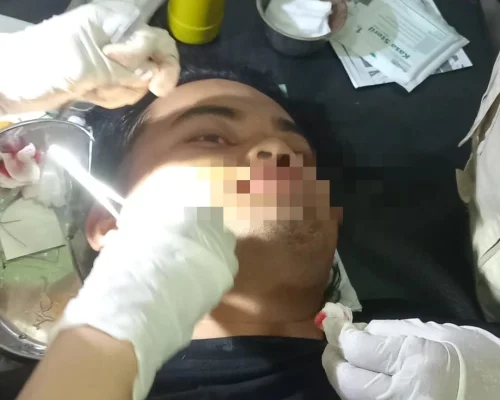 Pertunjukan Singo Ulung di Tasnan Memakan Korban, Warga Minta Pertanggungjawaban