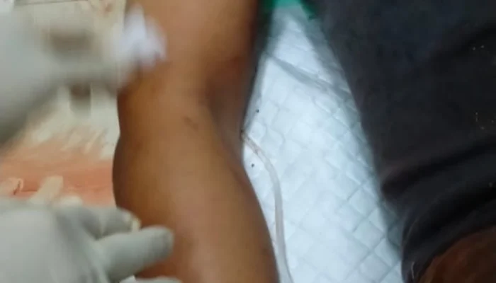 Gegara Asmara Pria di Banyuates Sampang Dibacok