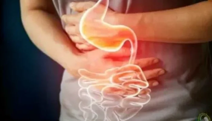 SERING SEMBELIT??? WASPADAI..!!! GEJALA HIRSCHSPRUNG